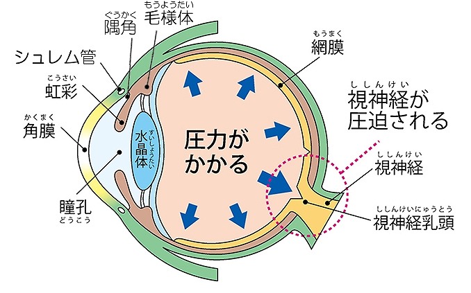 眼圧とは