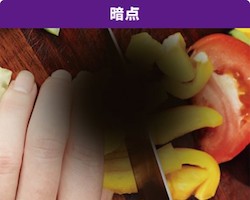 強度近視（病的近視）によって網膜や黄斑に障害がおよぶと、主に以下のような症状が現れます。